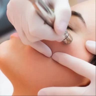 Intro Price Microdermabrasion at Radiant Reflections Spa in Moorhead, MN